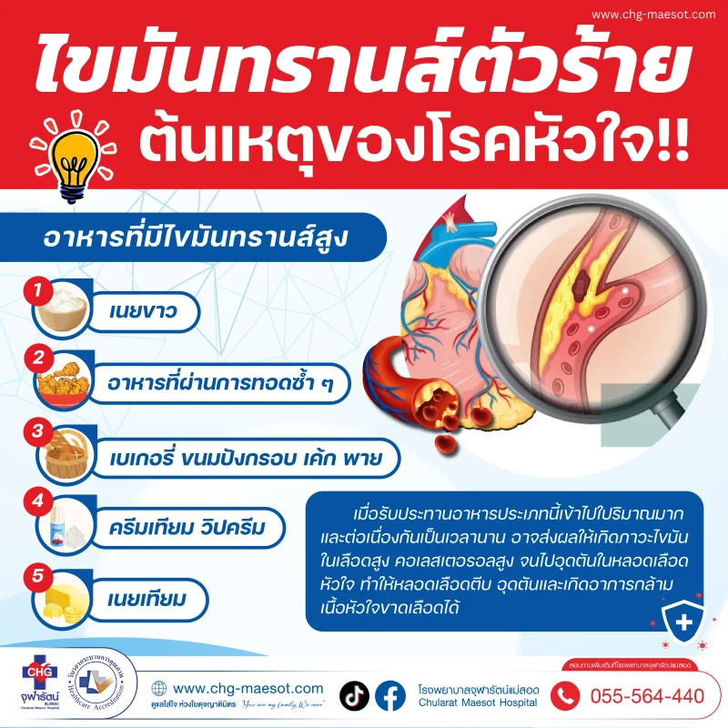 ไขมันทรานส์ "ร้ายสุด" ต้นเหตุของโรคหัวใจ!! 5 อาหารที่มีไขมันทรานส์สูง